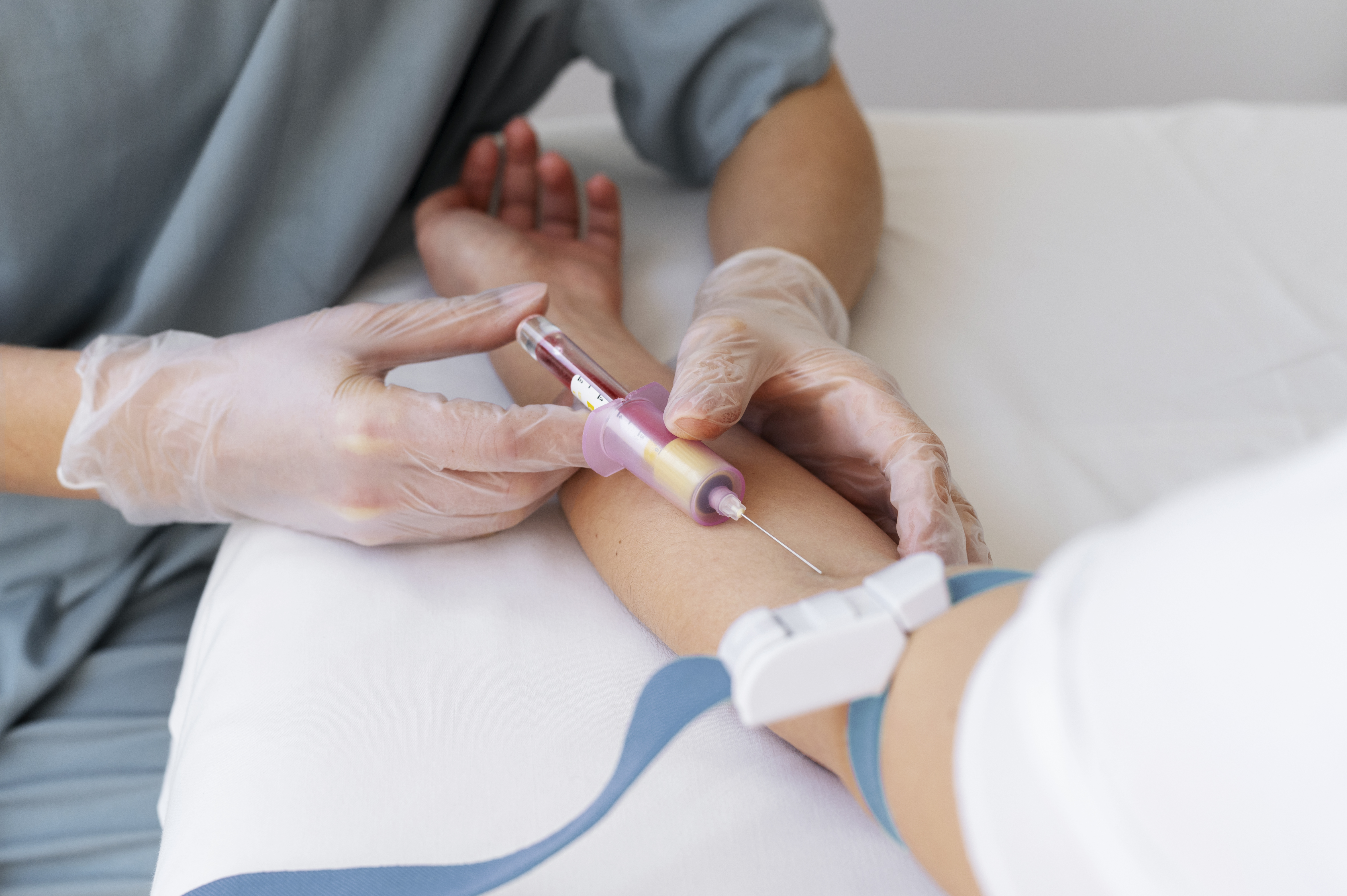Angiología y Cirugía Vascular